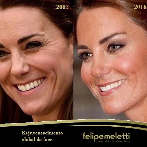 Rejuvenescimento global da face