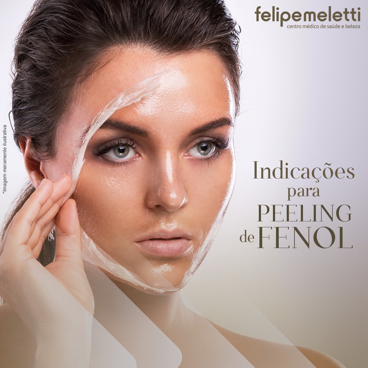 Indicações Para Peeling De Fenol Clínica Felipe Meletti 9411